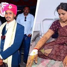 बुरहानपुर में पत्नी को जिंदा जलाने की घटना के बाद अस्पताल में भर्ती महिला